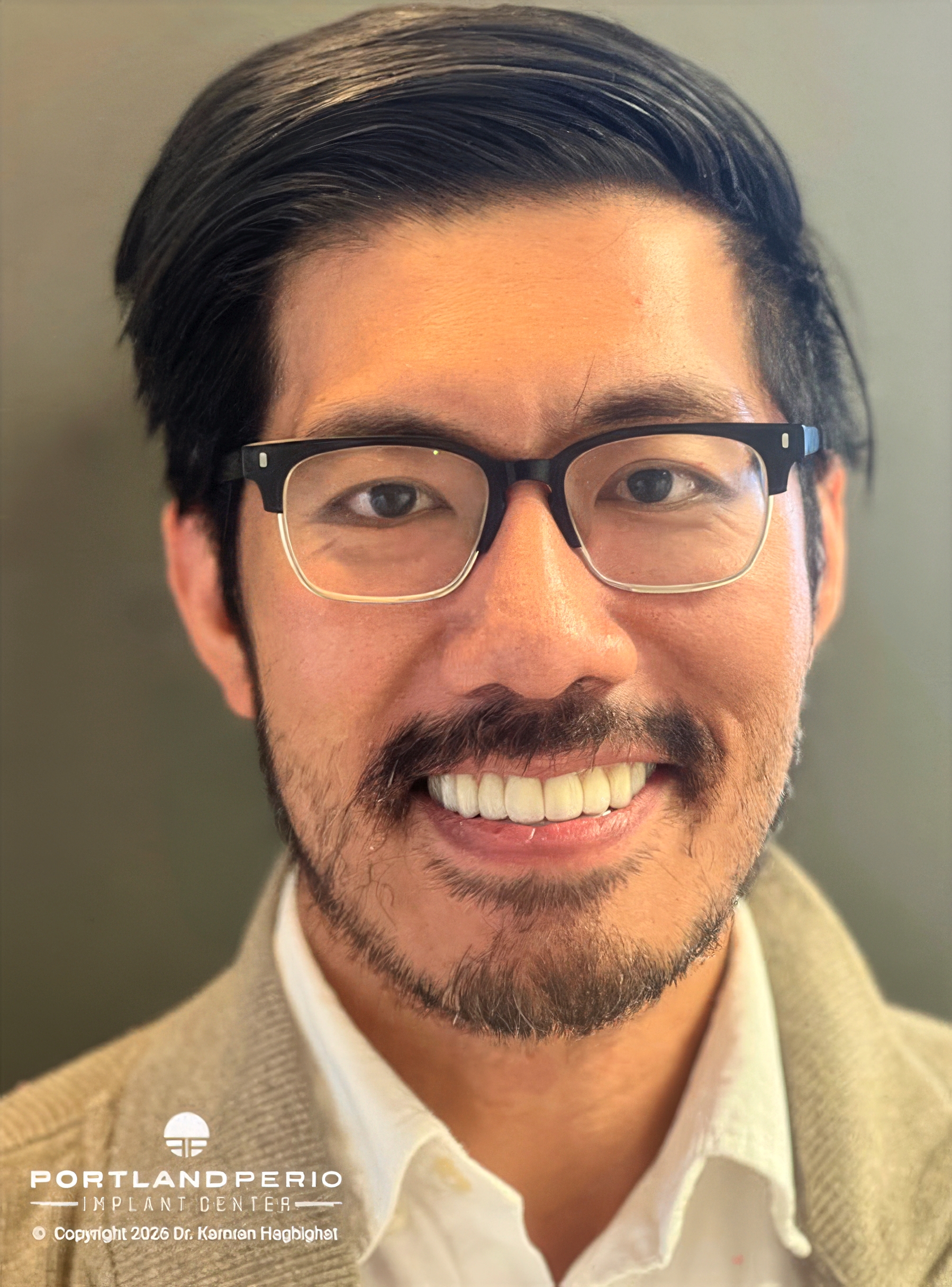 AFTER - Patient Story - Dr. Kamran Haghighat, Portland Perio Implant Center